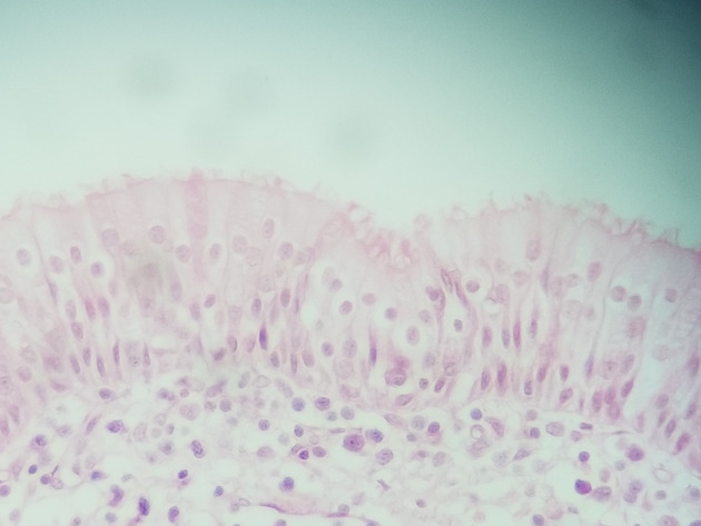 Pseudostratified Epithelium Slides - Pseudostratified Epithelium 02 400X